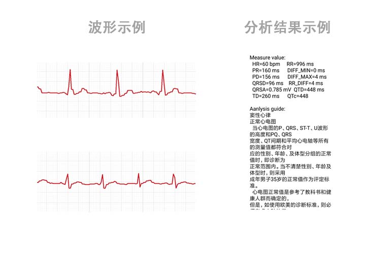 心電數(shù)據(jù)SDK算法庫(kù)----心電芯片、心電手環(huán)芯片、可穿戴心電設(shè)備、智能監(jiān)護(hù)儀