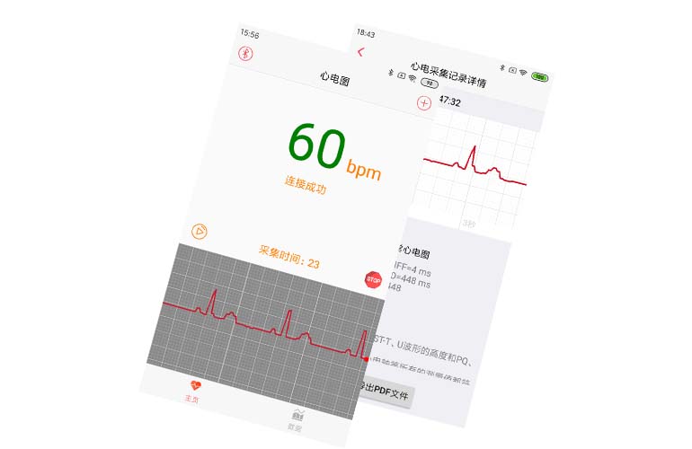 APP集成實(shí)例---心電芯片、心電手環(huán)芯片、可穿戴心電設(shè)備、智能監(jiān)護(hù)儀